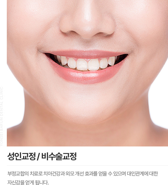 성인교정/비수술교정